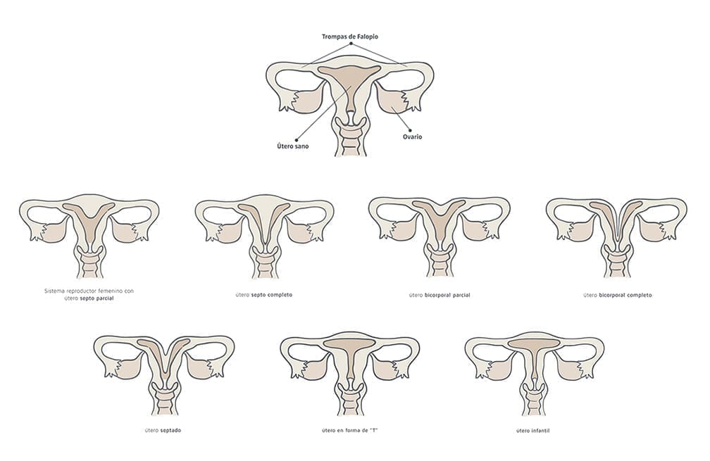 types-uterus