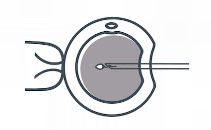 inyeccion-intracitoplasmatica