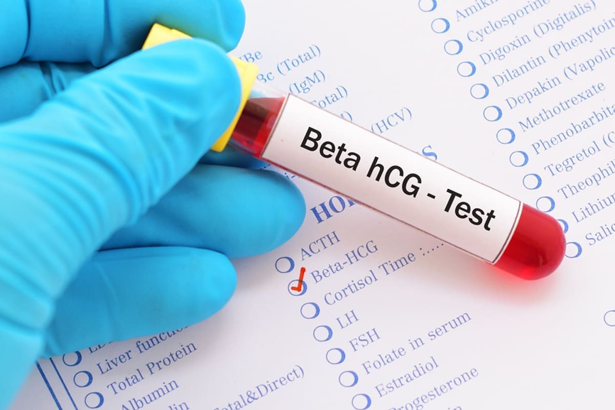 Beta positiva y sangrado online