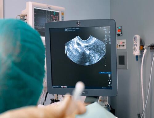 Come sapere se l’endometrio è ricettivo